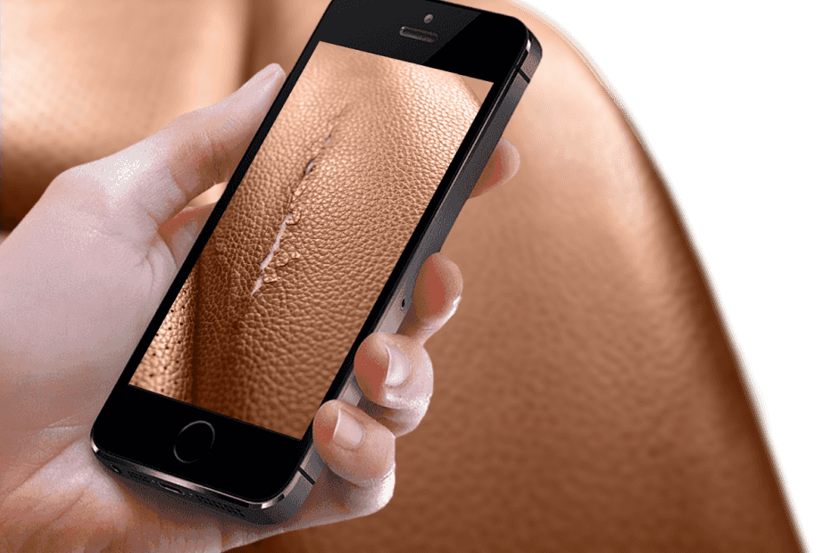 Leather repair